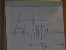 Erste Hilfe Auffrischung